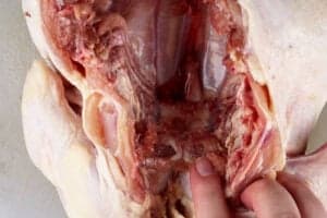 breast bone cartilage close up
